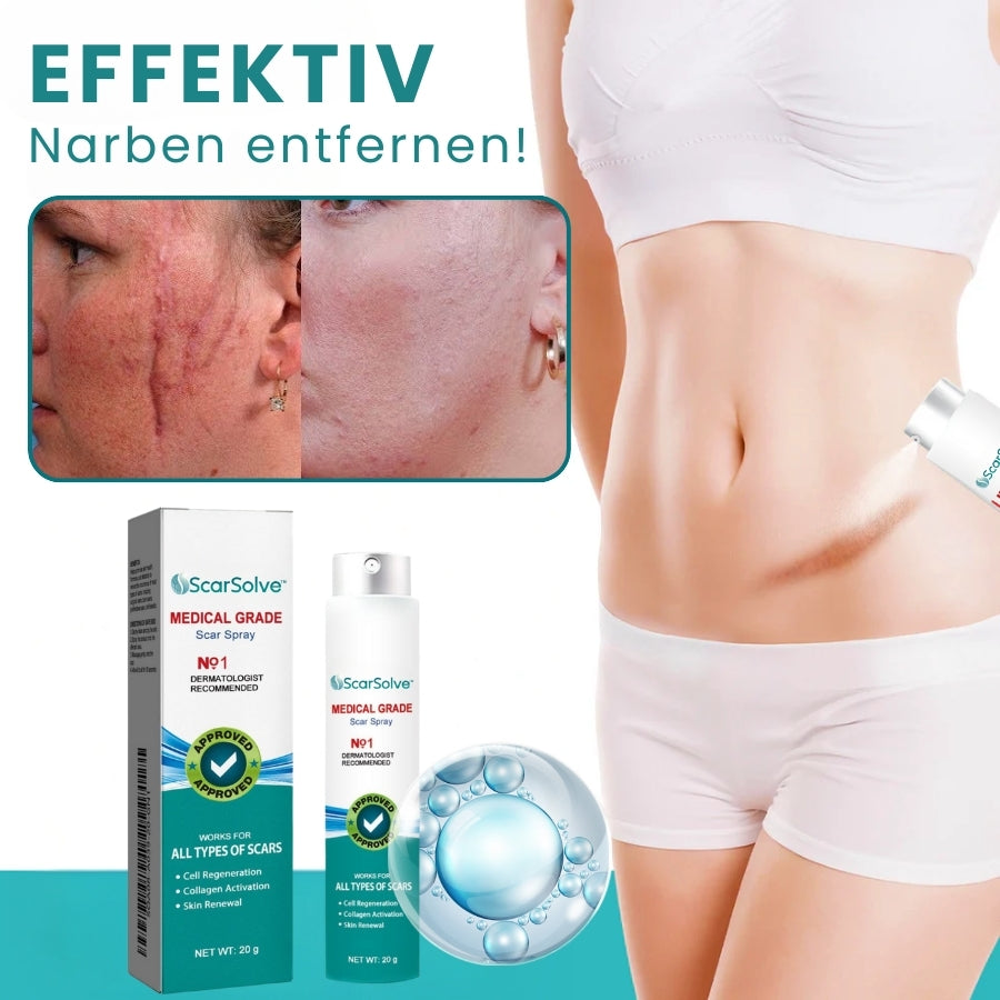ScarSolve™ | Medizinisches Narbenspray