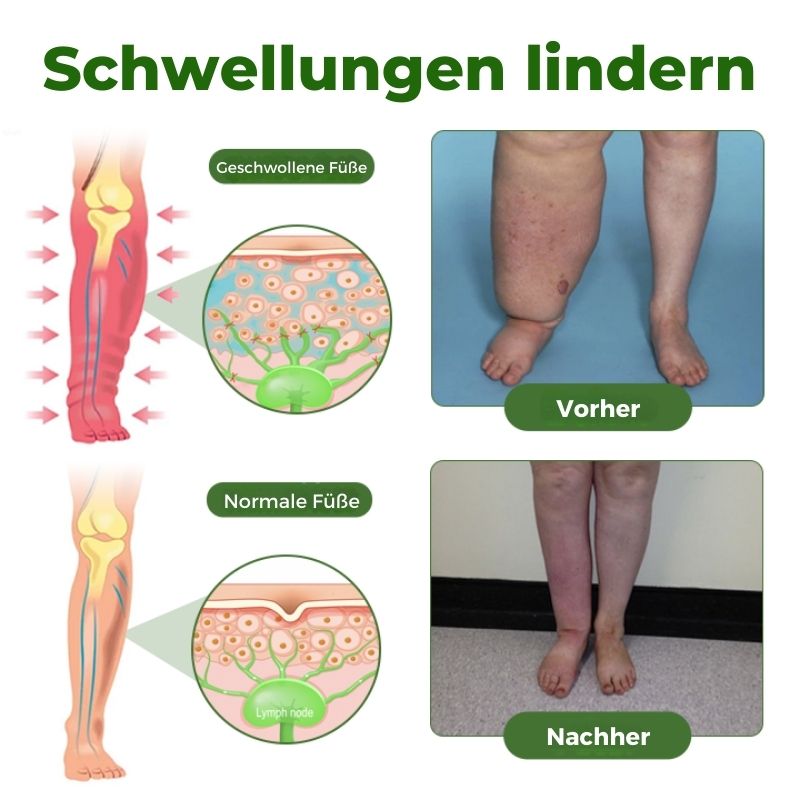 CalmLeg™ | Professionelle Bein-Circulationscreme