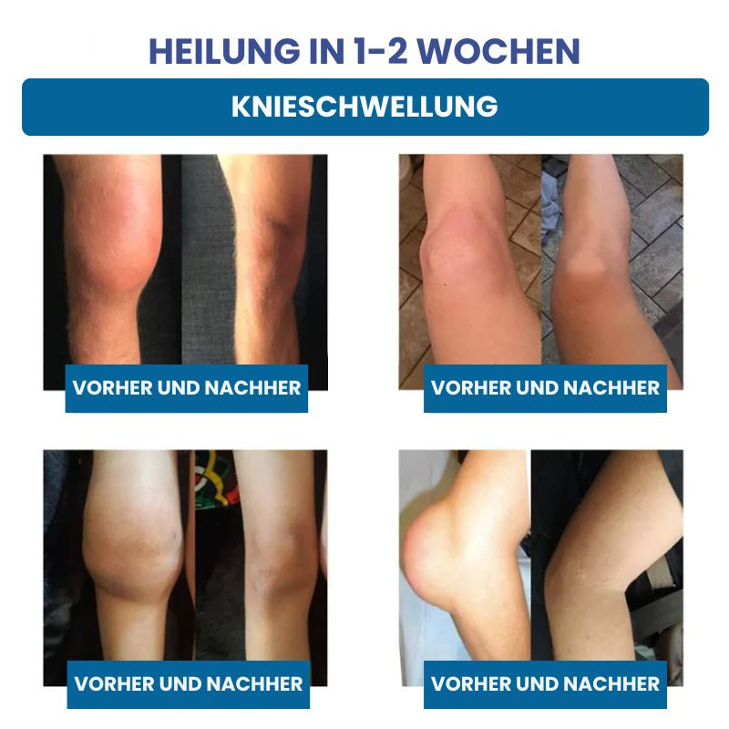 ReparaJoint™ | Stoppe Arthrose sofort und hole dir in nur 7 Tagen 95 % deiner Beweglichkeit zurück