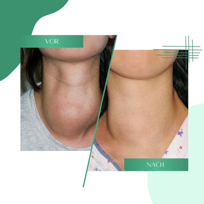 ThyroFlow™ | Hashimoto-Schilddrüsenunterstützungs-Formel