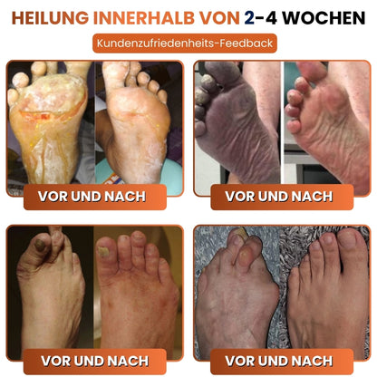 ReNerva™ | Vitamin-B-Komplex-Tropfen
