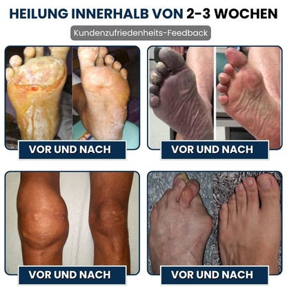 NervoVital™ | Nervenschmerz-Linderungscreme