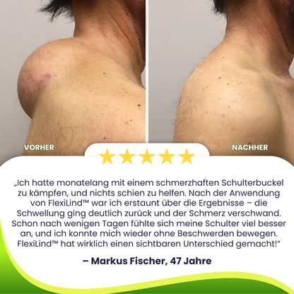 FlexiLind™ | Arthritis-Schmerzlinderung und Knochenheilungssalbe