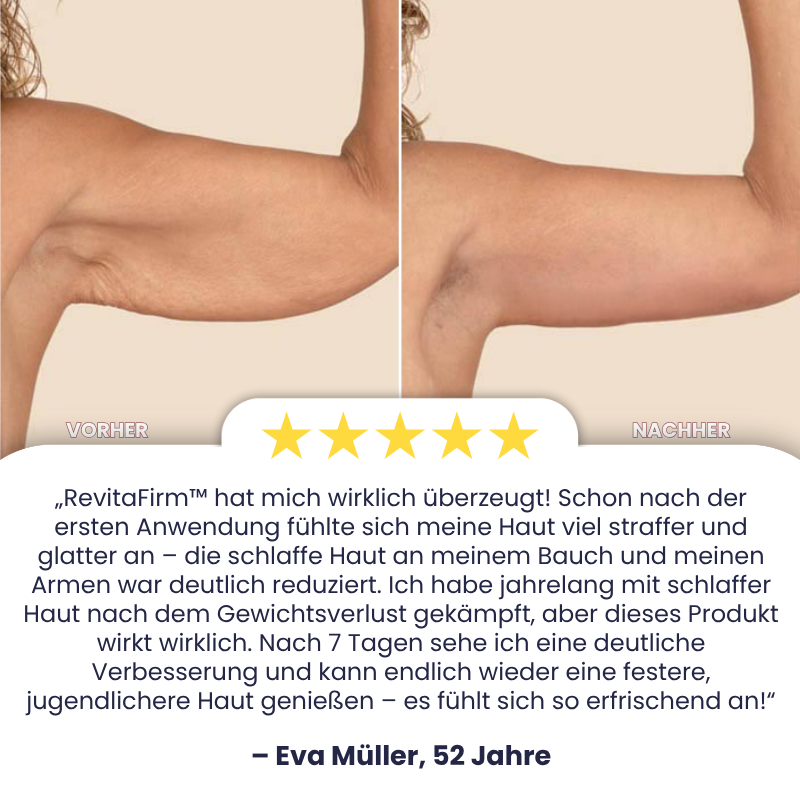 RevitaFirm™ | Collagen Anti-Aging Körperlotion