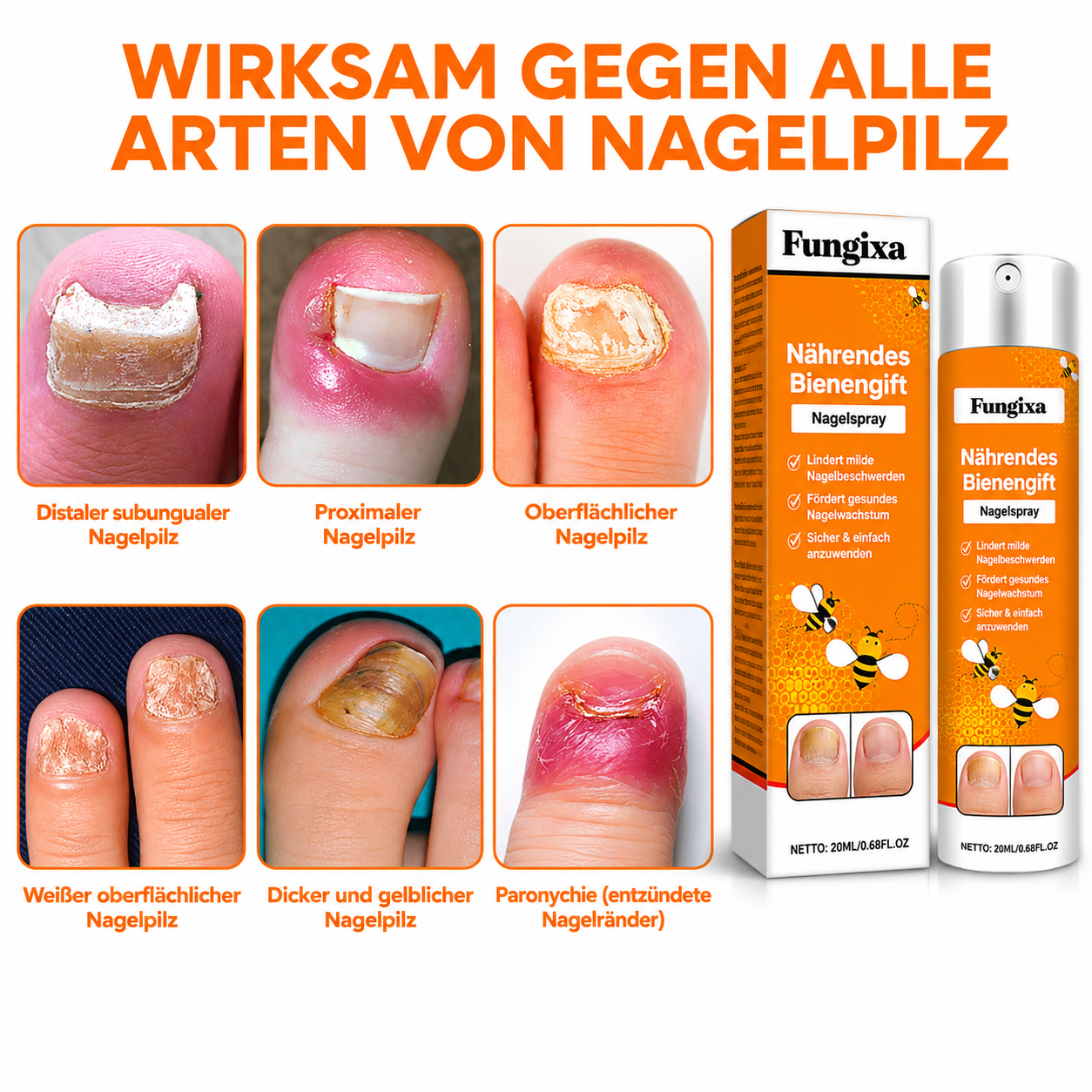 Fungixa™ Anti-Pilz-Spray