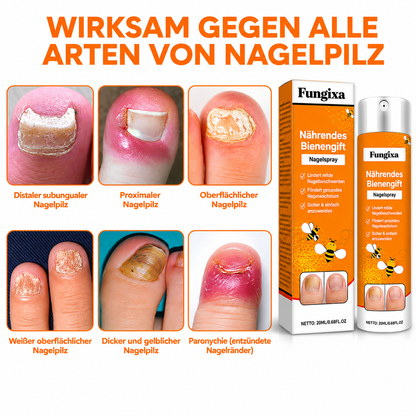 Fungixa™ Anti-Pilz-Spray