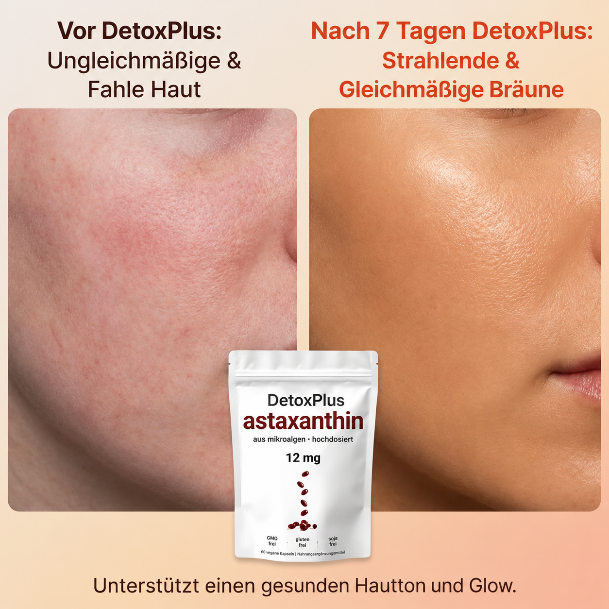 DetoxPlus™ | Soft Gels