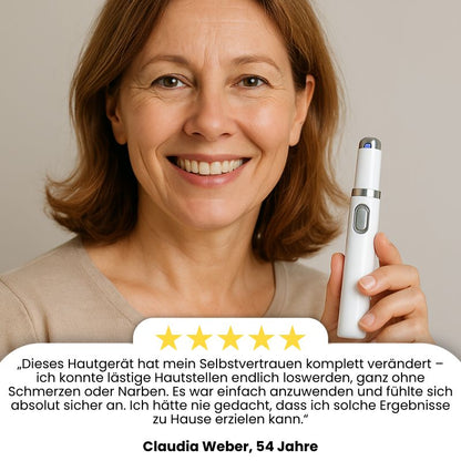LaserPen™ | Präziser Plasma-Hautkorrektor