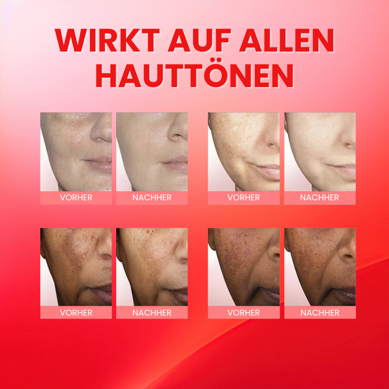 GlanzTon™ | Getönte, farbkorrigierende Gesichtscreme mit Lichtschutzfaktor (SPF)