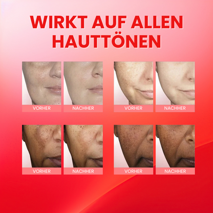 GlanzTon™ | Getönte, farbkorrigierende Gesichtscreme mit Lichtschutzfaktor (SPF)