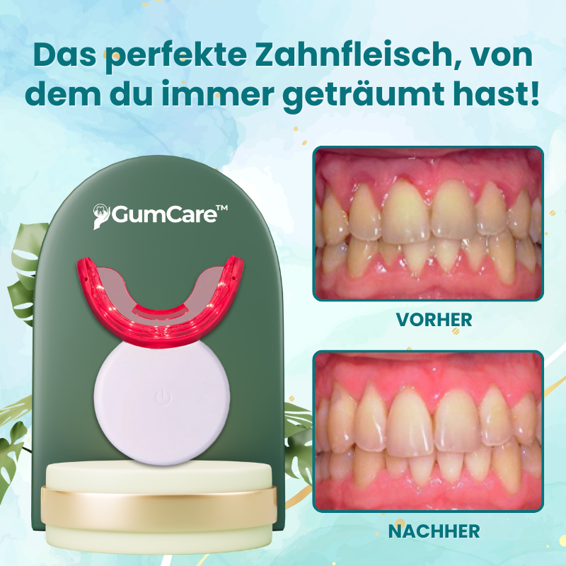 GumCare™ | Rote Lichttherapie-Gerät
