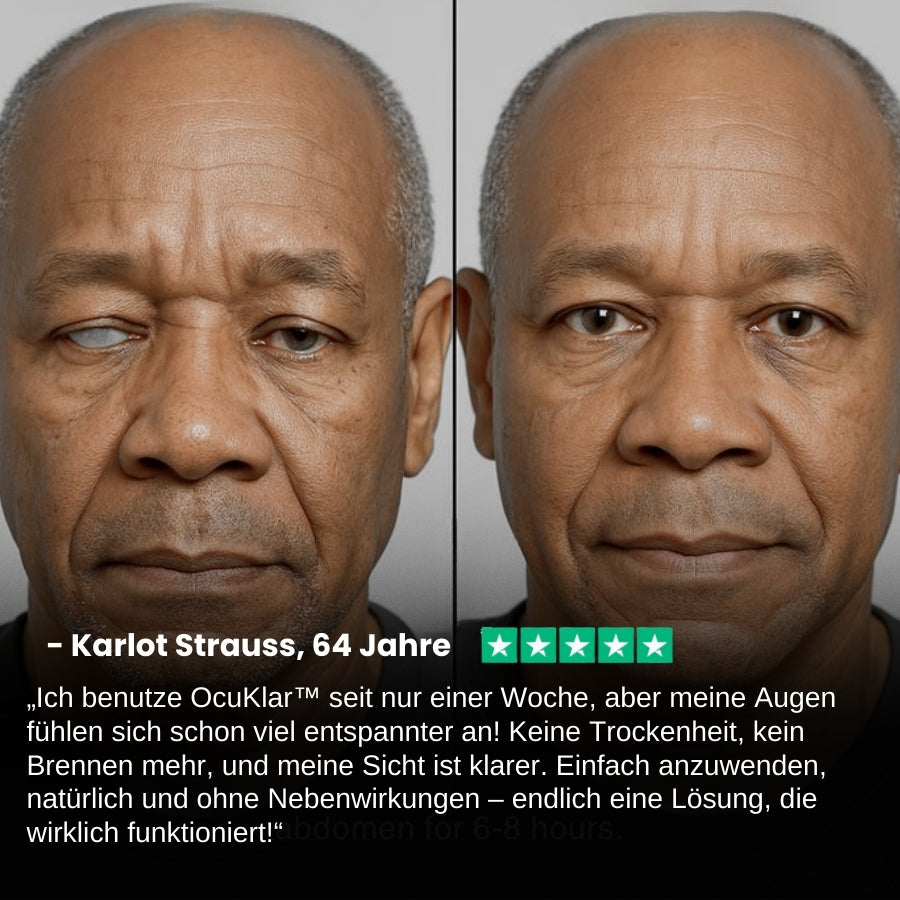 OcuKlar™ | Augengesundheits-Supplement
