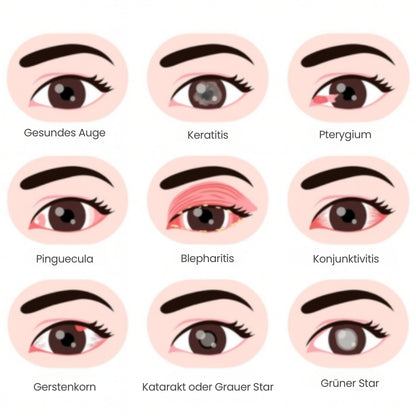 OcuKlar™ | Augengesundheits-Supplement