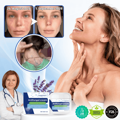 FungusFree™ | Antimykotische Creme