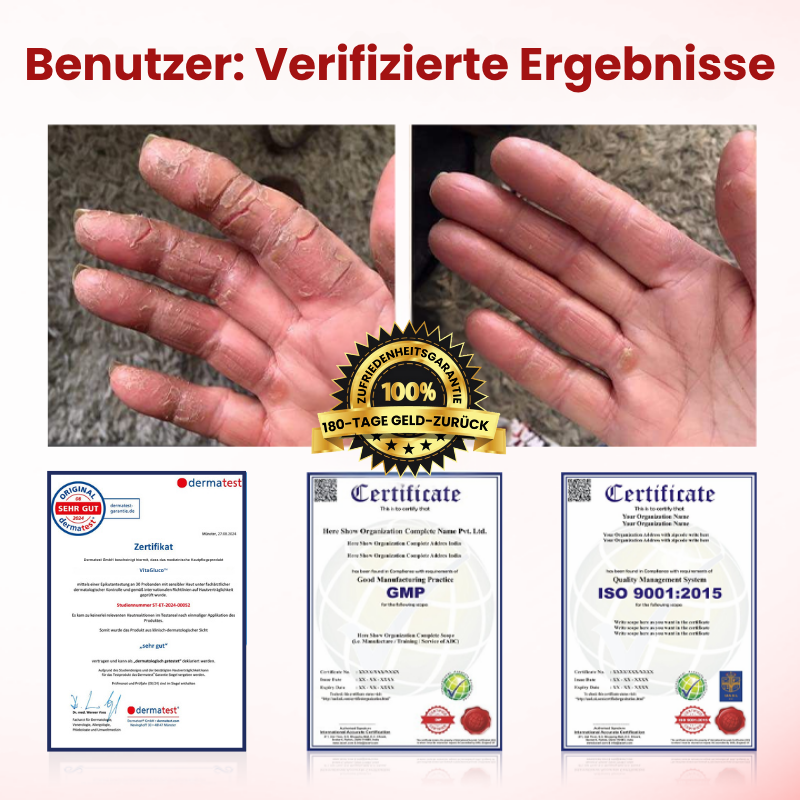 VitaGluco™ | Diabetische Wundpflegecreme