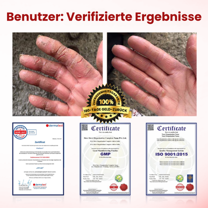 VitaGluco™ | Diabetische Wundpflegecreme