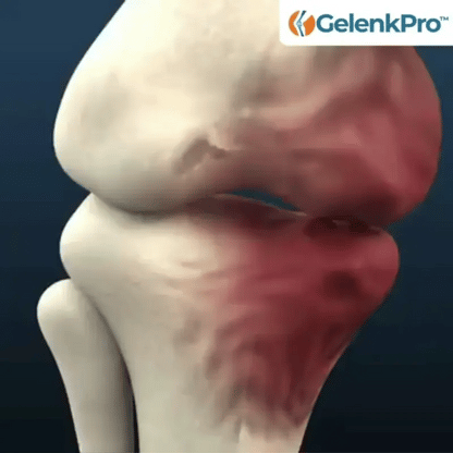 GelenkPro™ | Hyaluron-Creme gegen Gelenkschmerzen