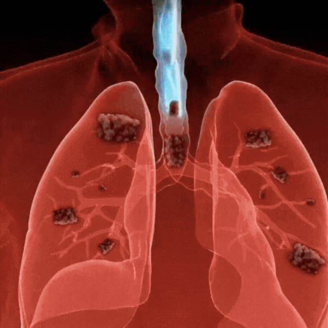 LungFree™ | Detox Kapseln
