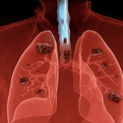 LungFree™ | Detox Kapseln