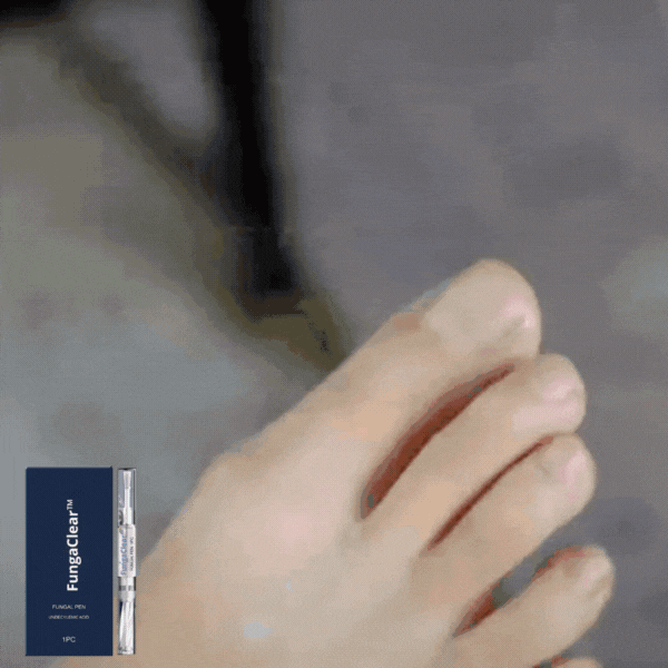 FungaClear™ Anti-Pilz-Stift
