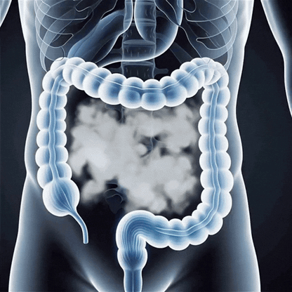 GutCleanse™ | Sanft-Kapseln