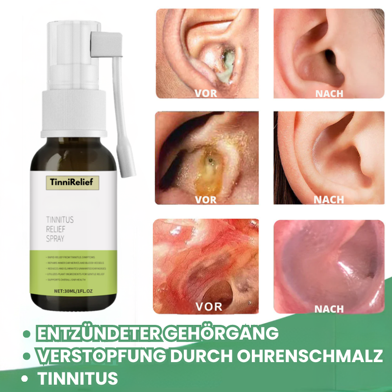 TinniRelief™ | Tinnitus Relief Spray
