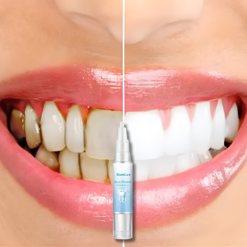 GumLux™ Teeth Repair Gel