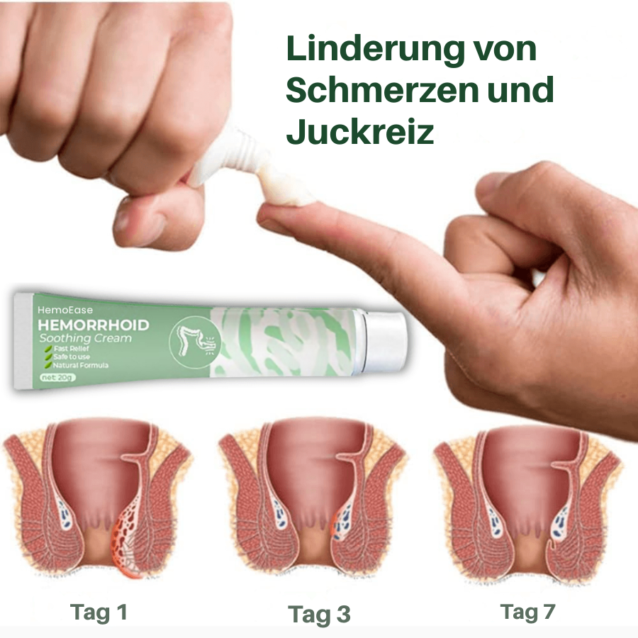 HemoEase™ Creme | Lindert 99 % der Hämorrhoidenschmerzen bereits bei der ersten Anwendung