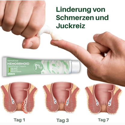 HemoEase™ Creme | Lindert 99 % der Hämorrhoidenschmerzen bereits bei der ersten Anwendung