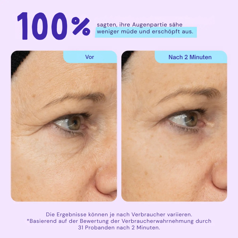 EyeBliss™ | Instant Lift Eye Gel