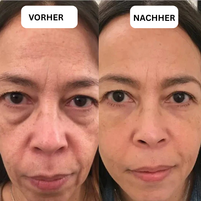 EyeBliss™ | Instant Lift Eye Gel
