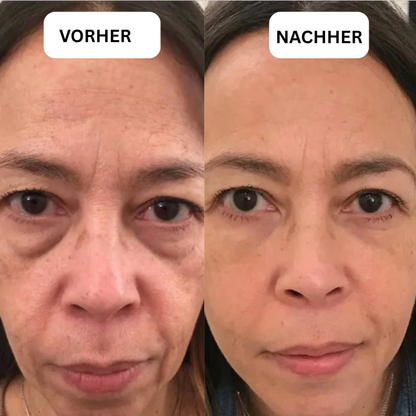EyeBliss™ | Instant Lift Eye Gel