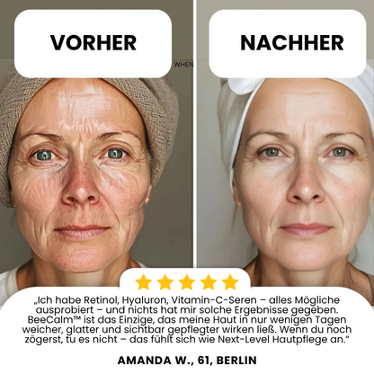 BeeCalm™ |  Deep Repair Balm