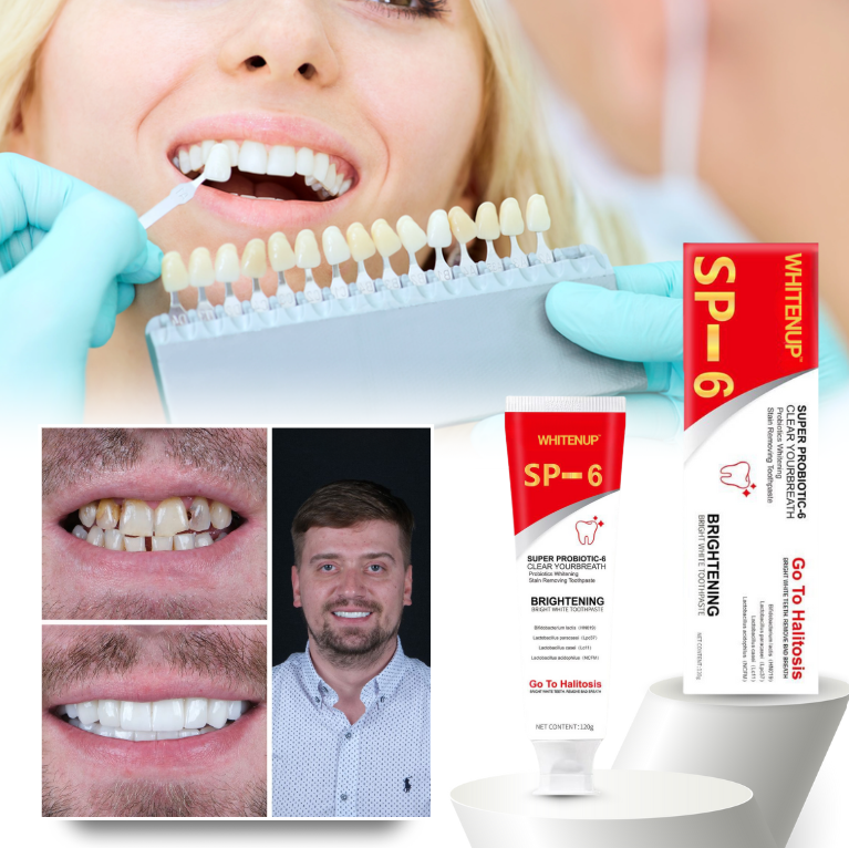 WhitenUp™ | SP-6 Aufhellende Zahnpasta