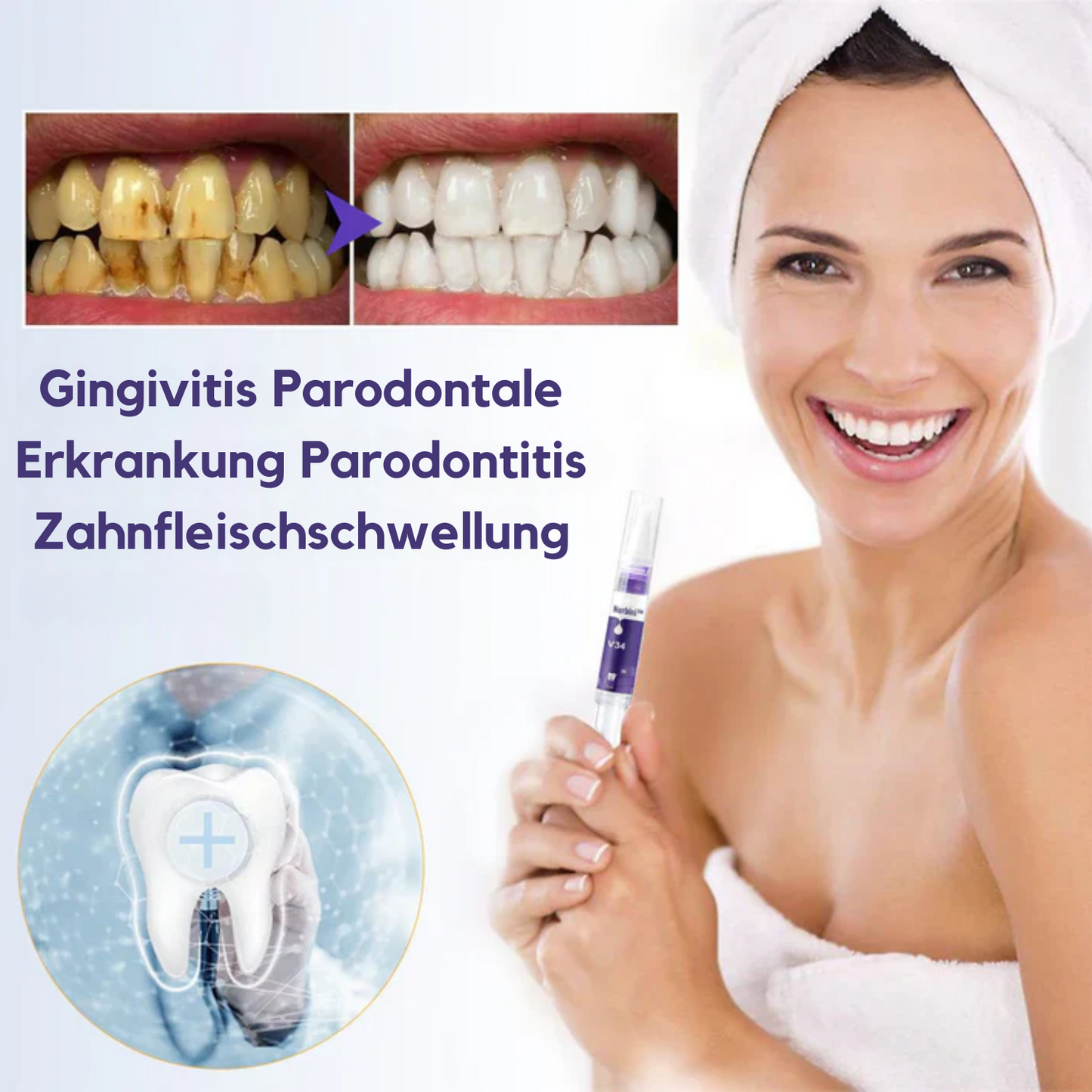 ZahnfleischVital™ | Baut zurückgehendes Zahnfleisch!