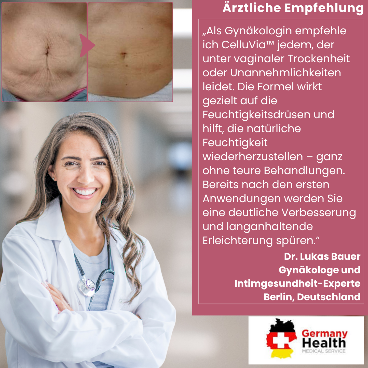 CelluVia™ | Stellt 98% der Feuchtigkeit in der Vagina