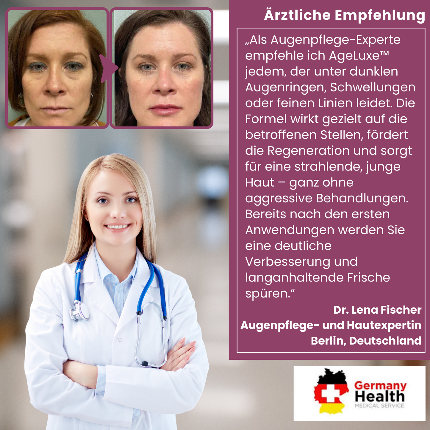 AgeLuxe™ | Bekämpfe dunkle Augenringe!