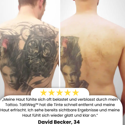 TattWeg™ Sprühflasche | 99% Tattoo Tinte entfernt!