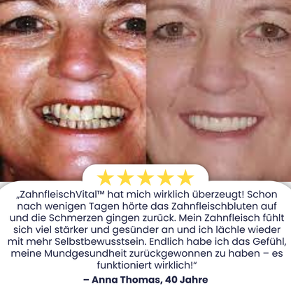 ZahnfleischVital™ | Baut zurückgehendes Zahnfleisch!