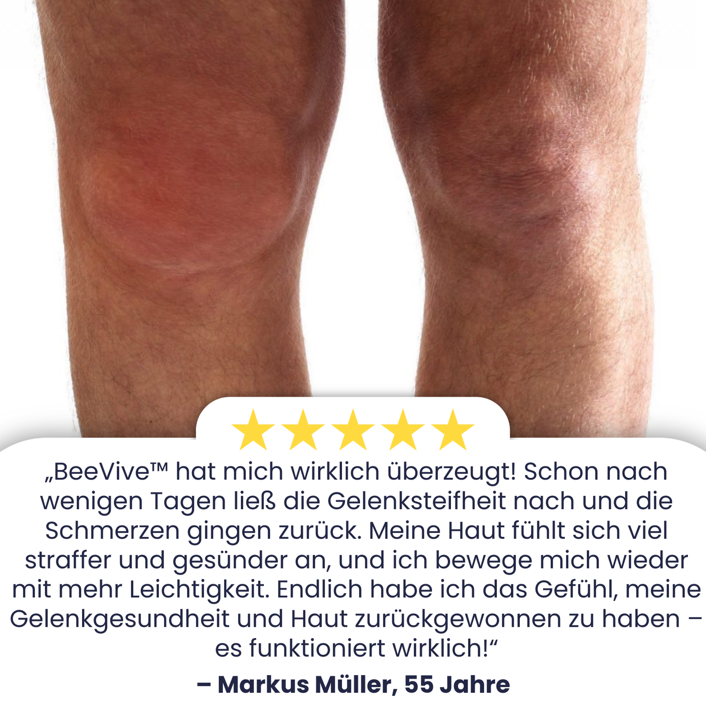 BeeVive™ Creme | Spüren Sie einen Unterschied von 97% in nur 7 Tagen!