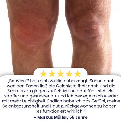 BeeVive™ Creme | Spüren Sie einen Unterschied von 97% in nur 7 Tagen!