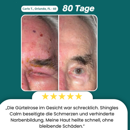 PeptideRelief™ | Beende Nervenqualen in 7 Tagen!
