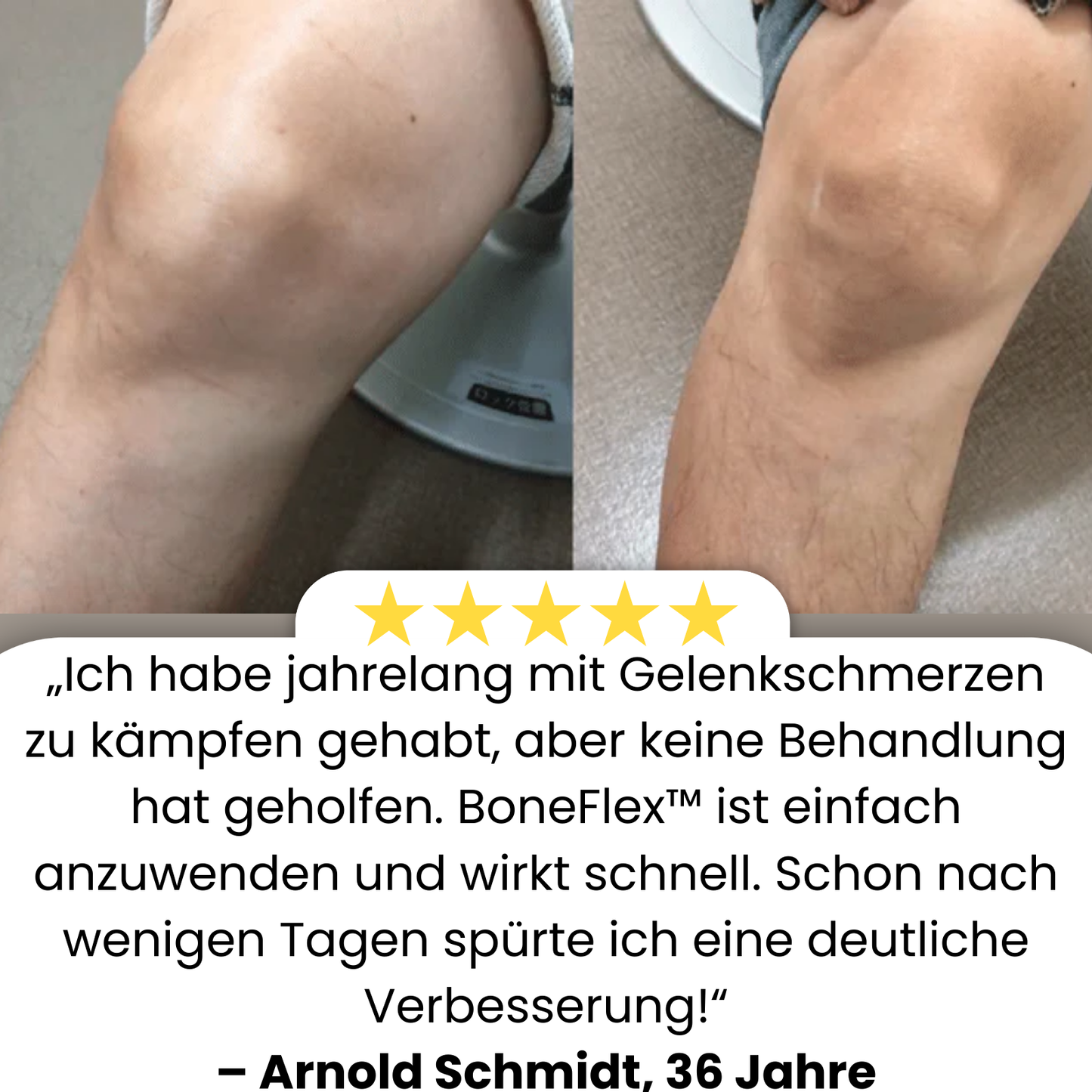 BoneFlex™ | 95% Flexibilität in 7 Tagen!