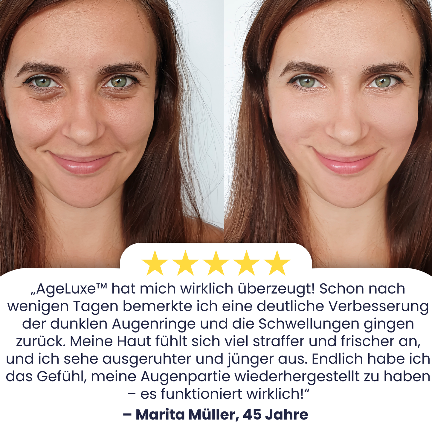 AgeLuxe™ | Bekämpfe dunkle Augenringe!