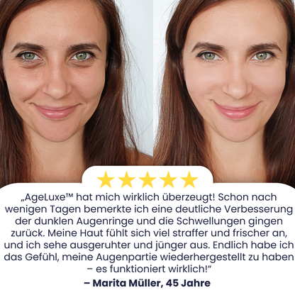 AgeLuxe™ | Bekämpfe dunkle Augenringe!