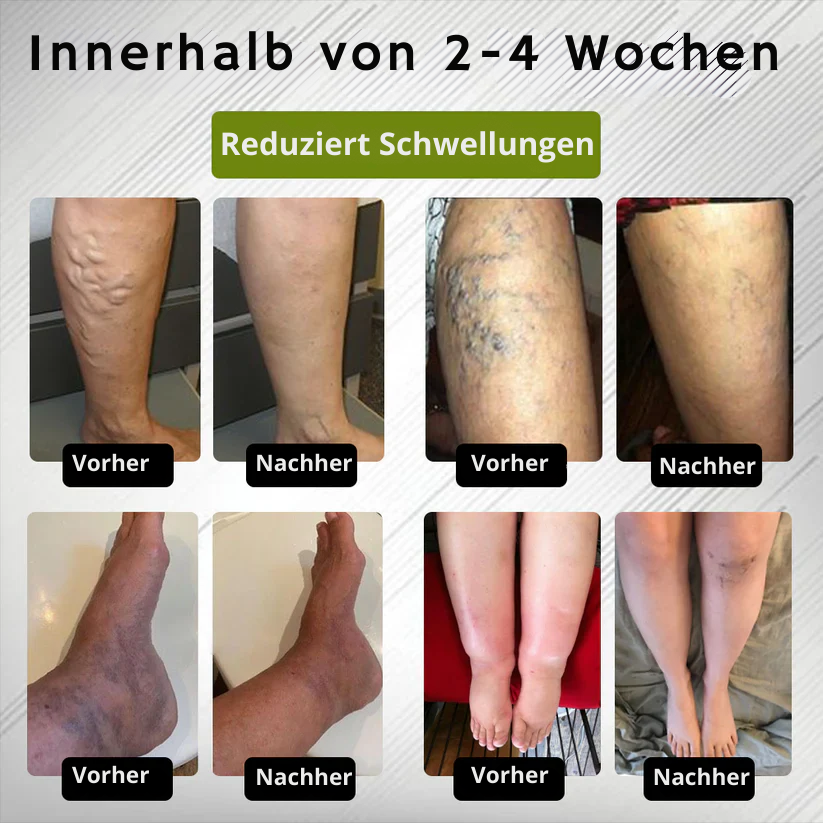 LinderSchritt™ | Besiege Fußschmerzen jetzt