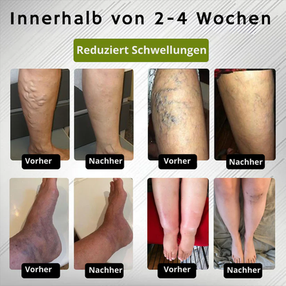 LinderSchritt™ | Besiege Fußschmerzen jetzt