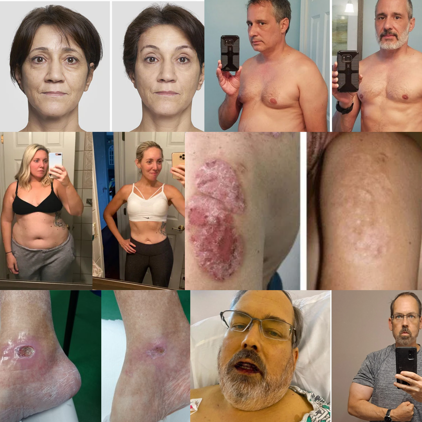 GlycoFlush™ | Senken Sie Ihren Blutzucker!
