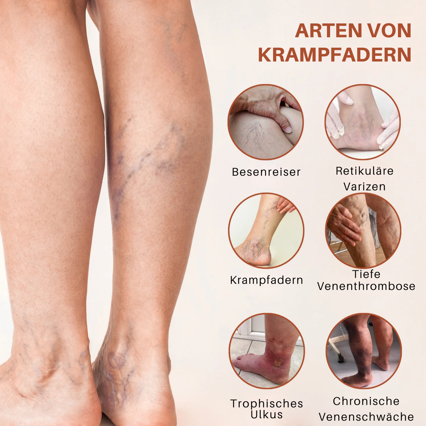 VeinTarget™ | 95 % Linderung – Sichtbare Venenveränderung