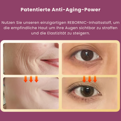 AgeLuxe™ | Bekämpfe dunkle Augenringe!